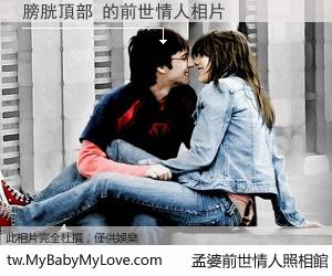 膀胱頂部 的前世情人